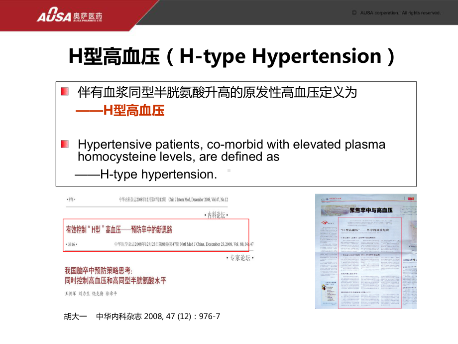 H型高血压的危害-课件.ppt_第2页