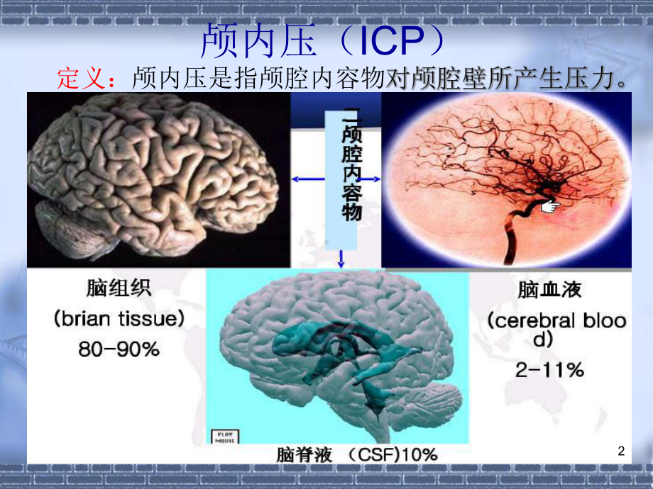 颅内压增高病人的护理PPT幻灯片课件.ppt_第2页