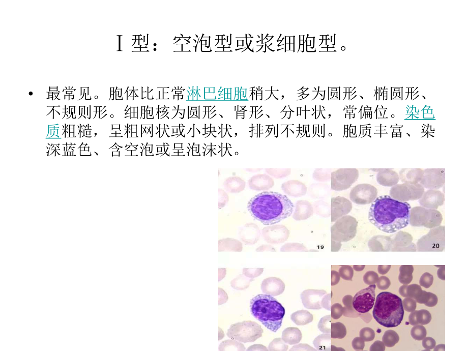 异常淋巴细胞形态课件 (2).ppt_第3页