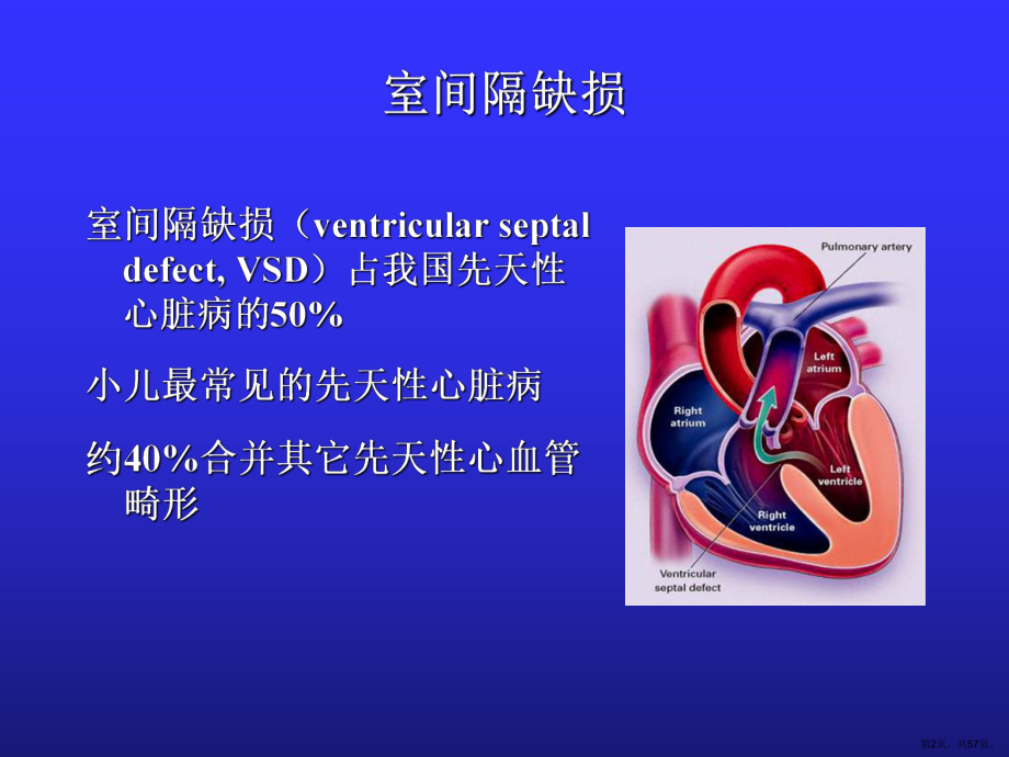 (儿科学课件)第十三章先天性心脏病(VSdtofPDA)(PPT 57页).pptx_第2页