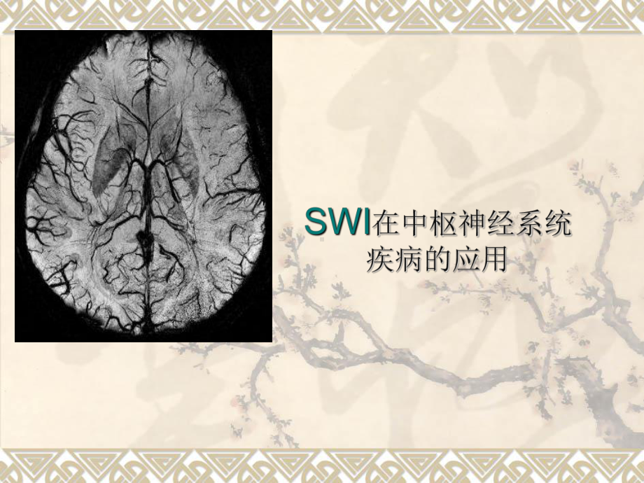 swi在中枢神经系统应用ppt课件-PPT精选文档.ppt_第1页