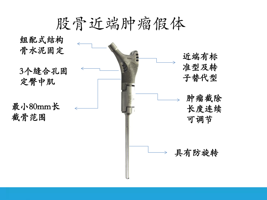 股骨近端肿瘤课件.pptx_第2页