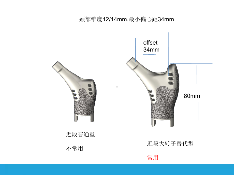 股骨近端肿瘤课件.pptx_第3页