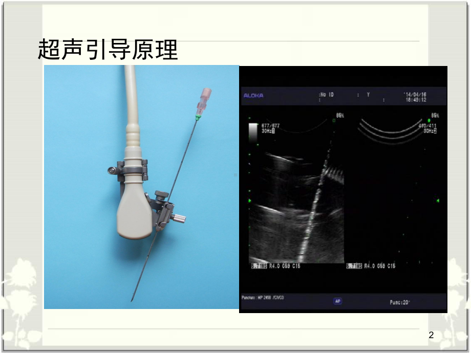 超声引导下甲状腺结节细针穿刺技术医学PPT课件.ppt_第2页