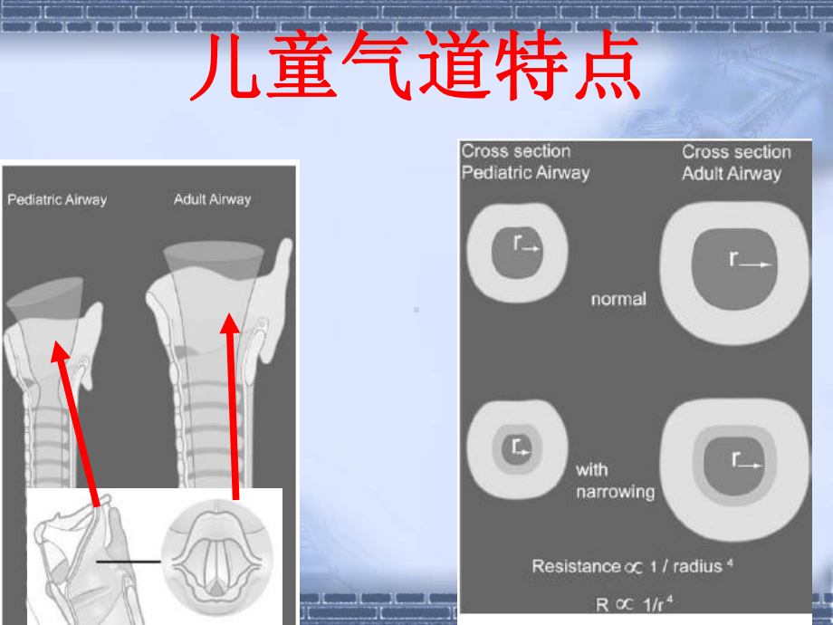 高级气道管理课件.ppt_第2页