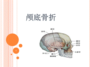 颅底骨折护理标准PPT幻灯片课件.ppt