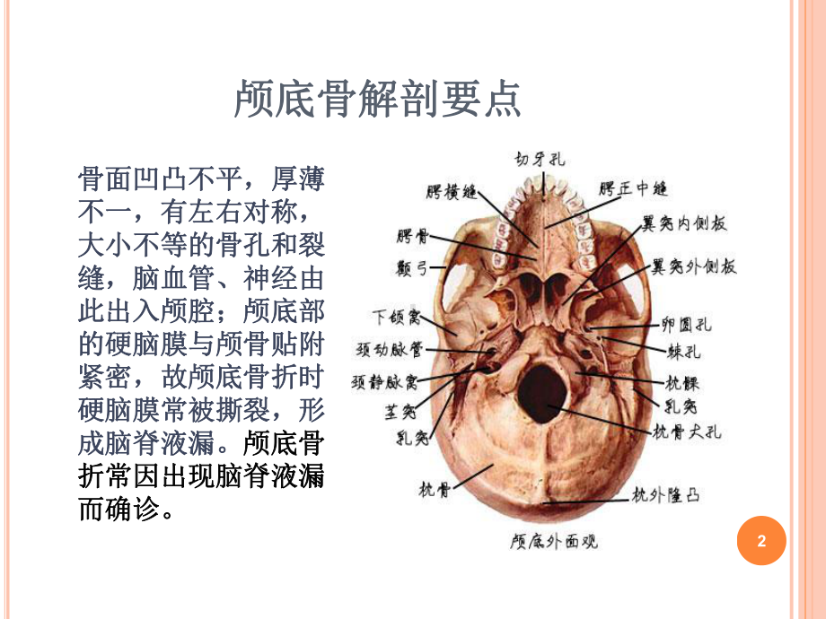 颅底骨折护理标准PPT幻灯片课件.ppt_第2页