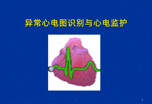 心电图与心电监护PPT课件.ppt