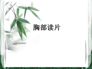 胸部读片-肺出血肾炎综合征课件.ppt