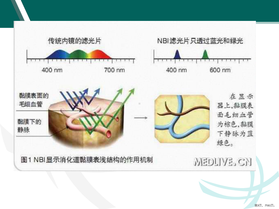 NBI内镜在消化道早癌诊断中应用课件(PPT 61页).pptx_第3页