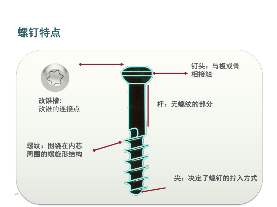 骨科基础-螺钉设计与类型课件.pptx_第3页