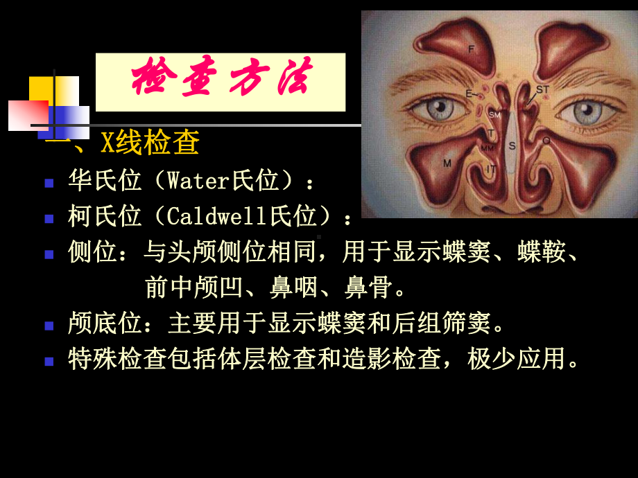 鼻及鼻窦影像诊断-PPT课件.ppt_第2页