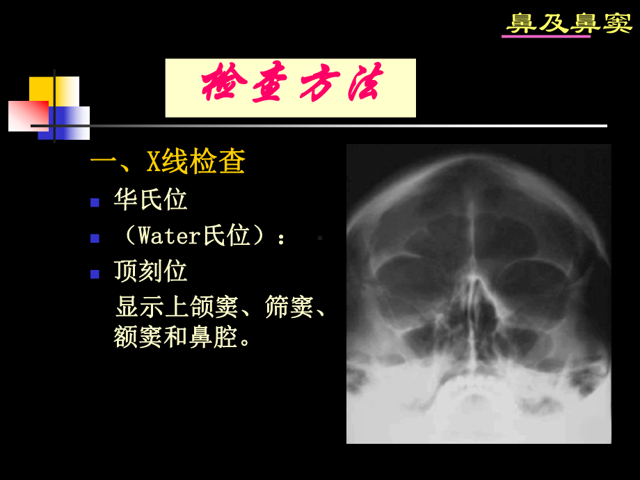 鼻及鼻窦影像诊断-PPT课件.ppt_第3页