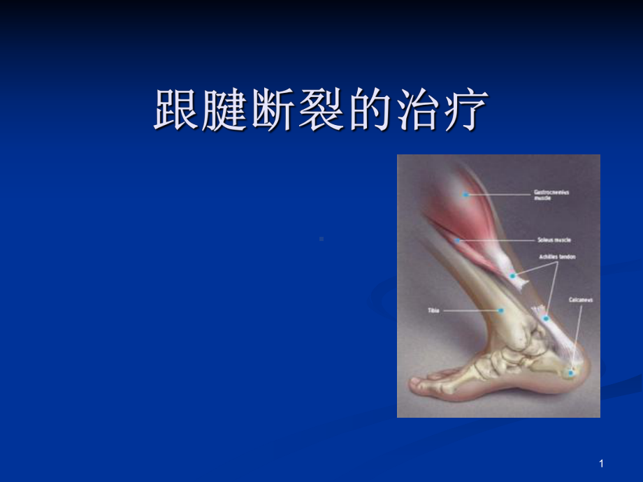 跟腱断裂PPT幻灯片课件.ppt_第1页