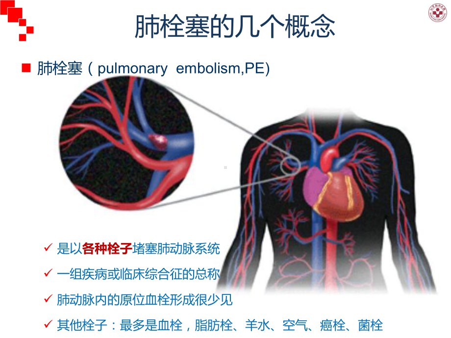 肺栓塞诊疗常规于指南解读课件.ppt_第3页