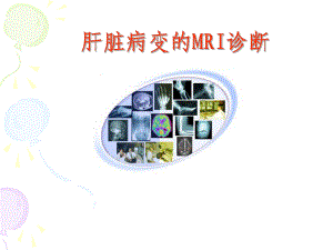 肝脏病变的MRI诊断课件.ppt