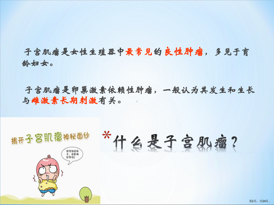 子宫肌瘤宣教1课件(PPT 24页).pptx_第2页