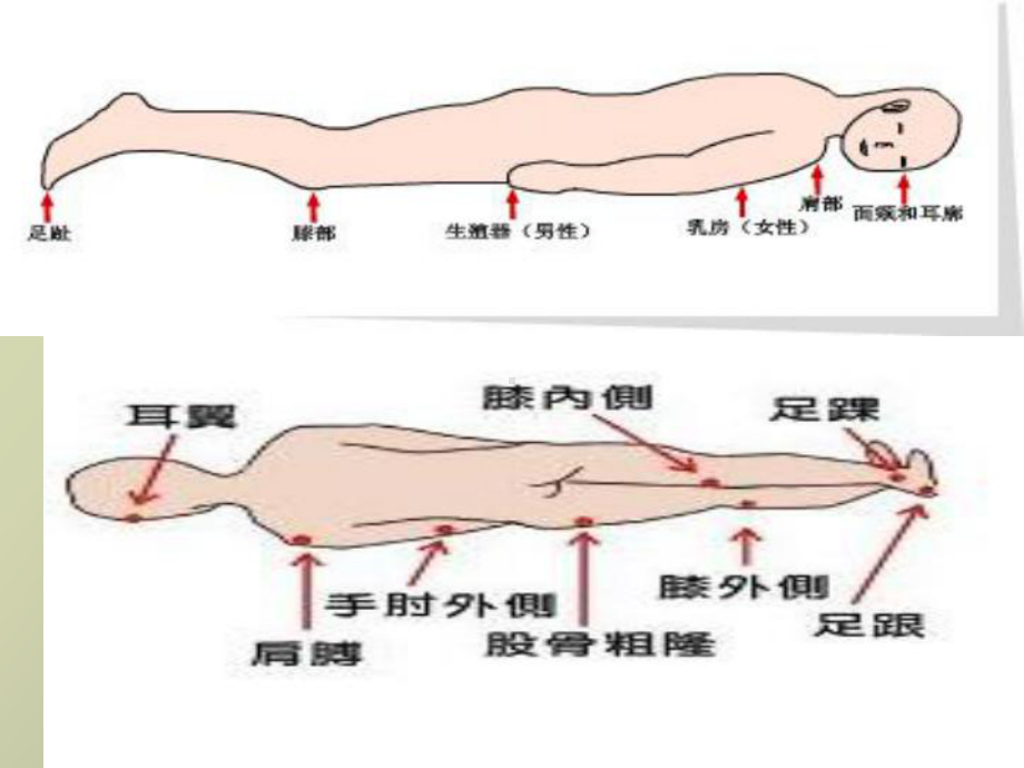 （课件）压疮湿性愈合理论.ppt_第3页