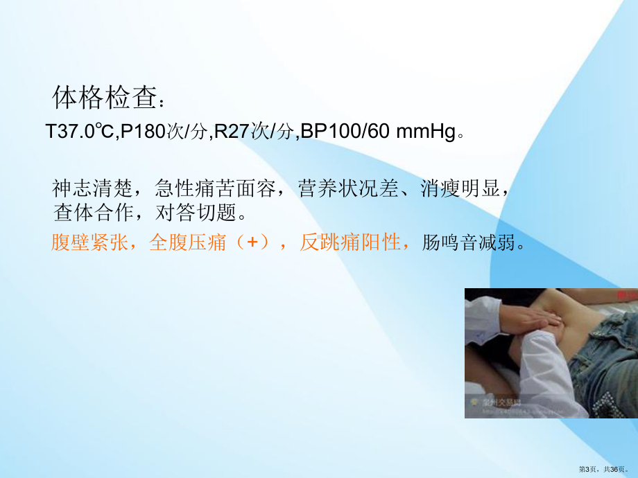 急性腹膜炎并发感染性休克课件(PPT 36页).pptx_第3页