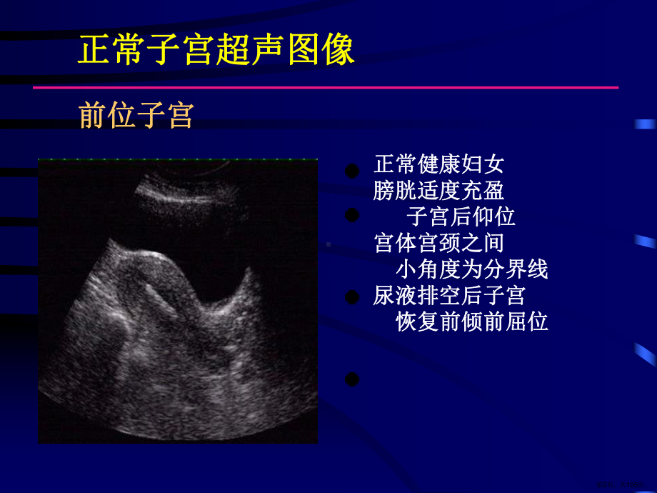 妇科疾病超声检查图谱解析课件(PPT 105页).pptx_第2页