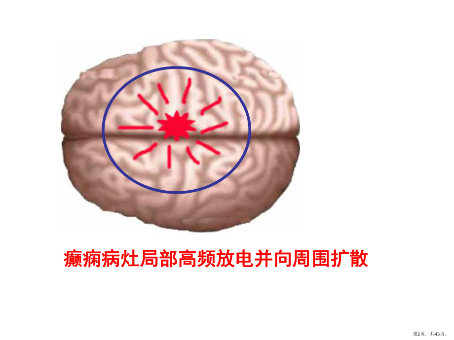 《抗癫痫药》PPT课件(PPT 45页).pptx_第2页