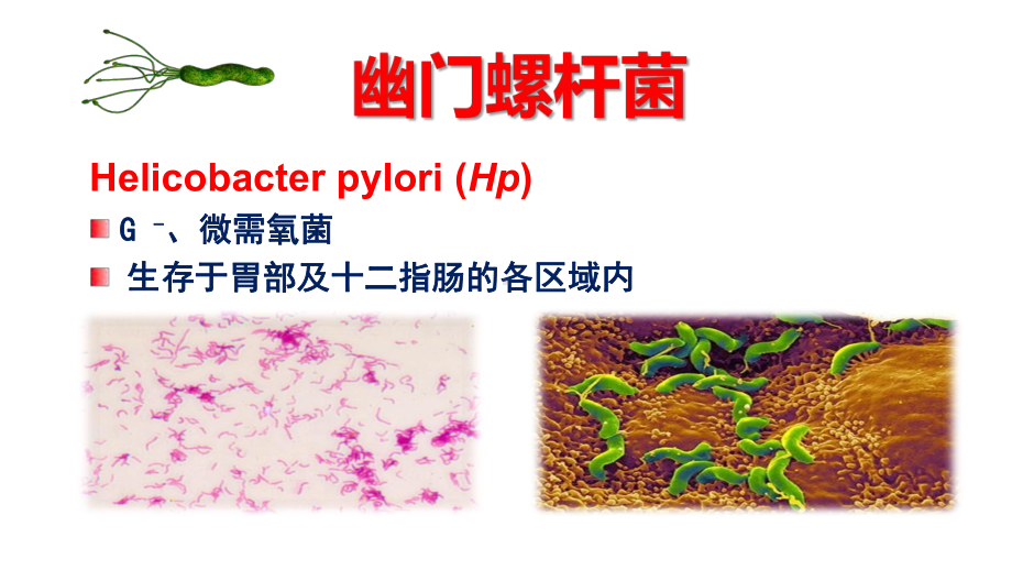 （消化-儿童-课件）儿童和青少年幽门螺杆菌诊治ESPGHANNASPGHAN-指南解读.pptx_第2页