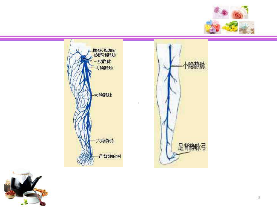 下肢深静脉血栓形成的介入治疗ppt课件.ppt_第3页