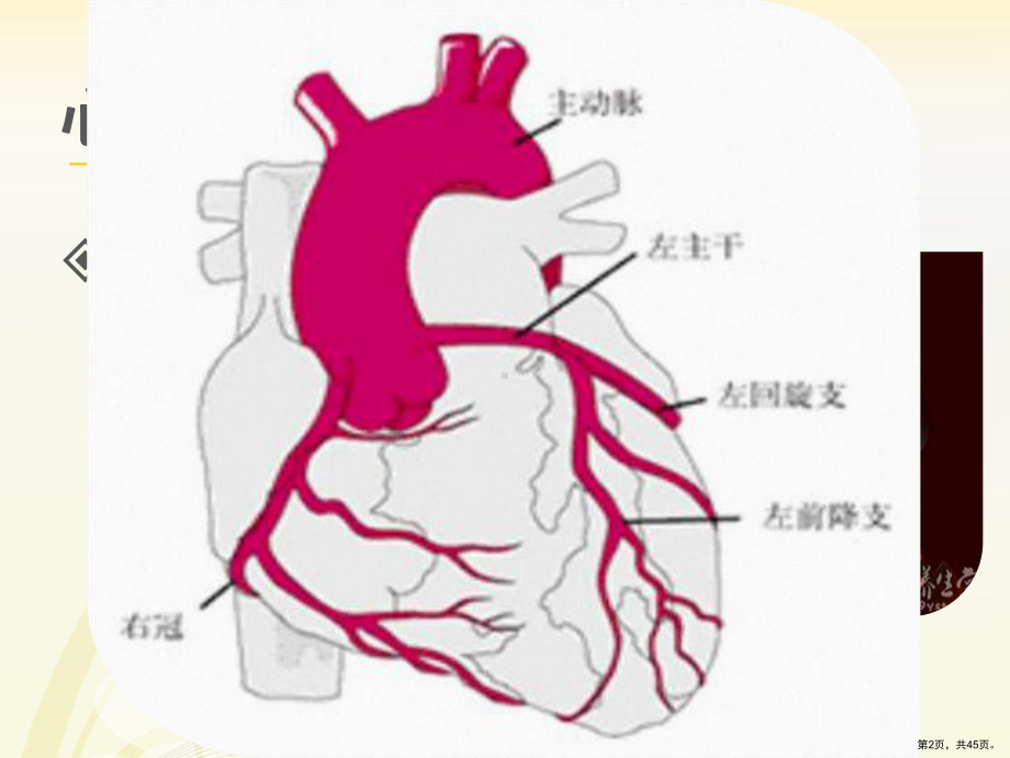 心肌梗塞护理查房PPT课件(PPT 45页).pptx_第2页