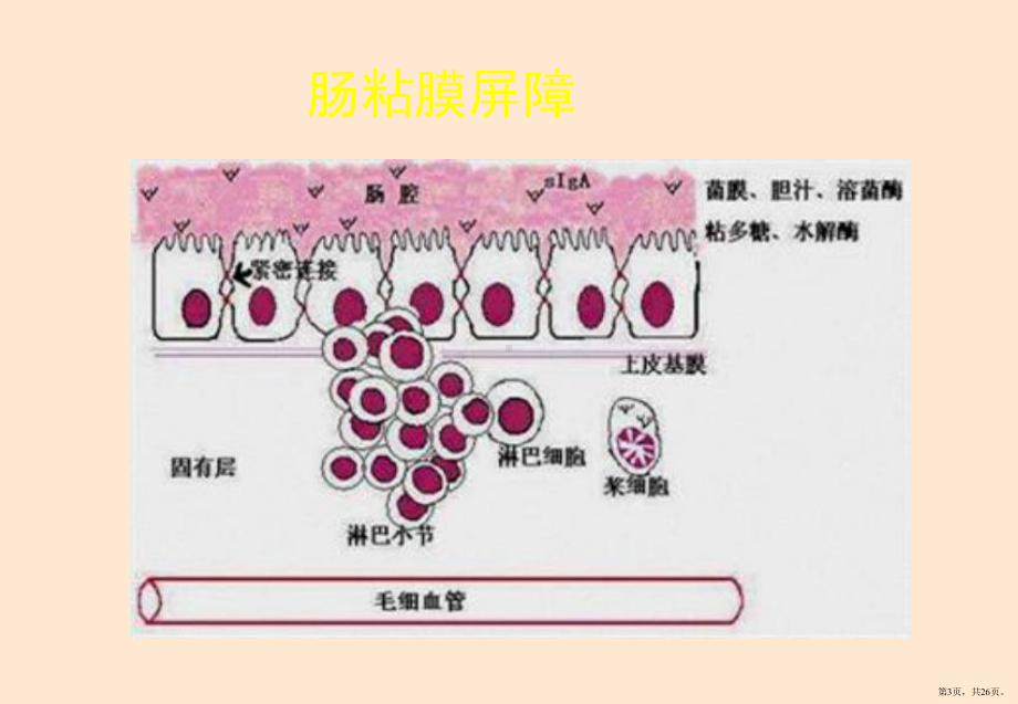 丁酸梭菌治疗炎症性肠病课件(PPT 26页).pptx_第3页