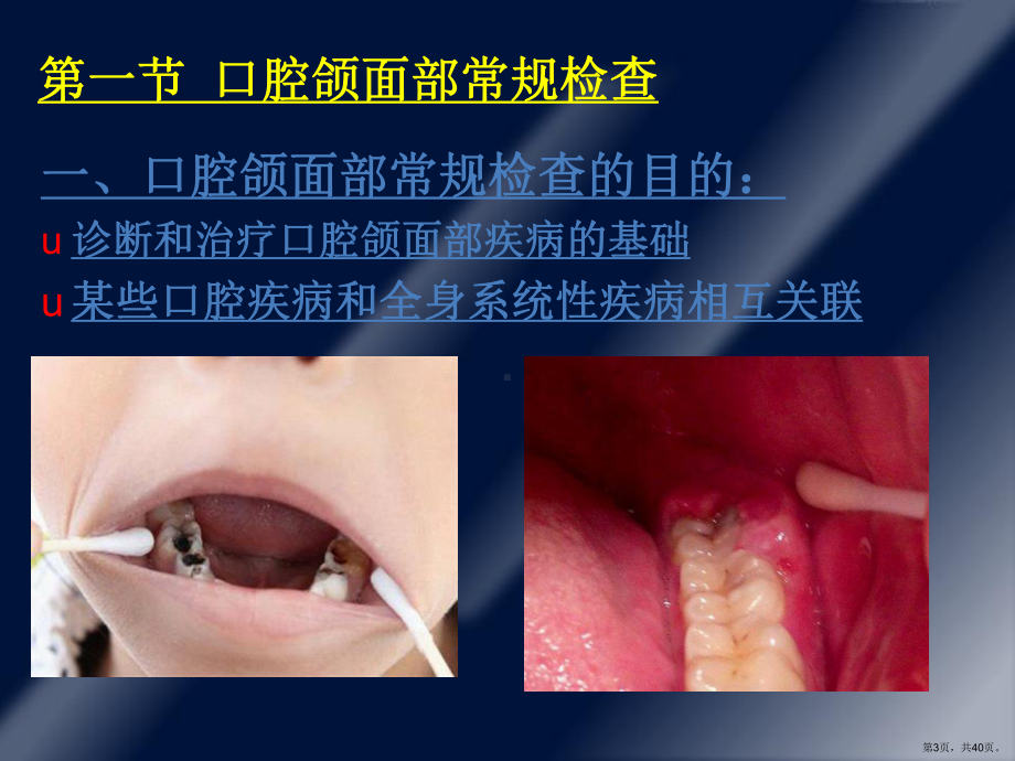 口腔科学口腔颌面部检查课件(PPT 40页).pptx_第3页