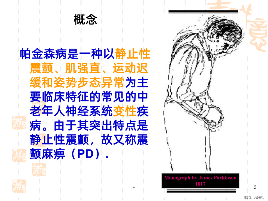 内科护理学-帕金森病的护理PPT课件(PPT 34页).pptx_第3页