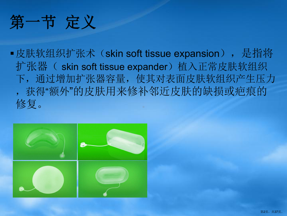 扩张器PPT幻灯片课件(PPT 37页).pptx_第2页