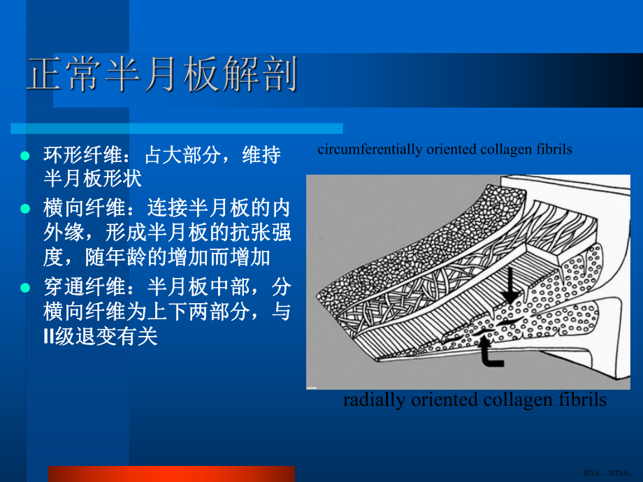 半月板病变的mr诊断ppt课件(PPT 73页).pptx_第3页