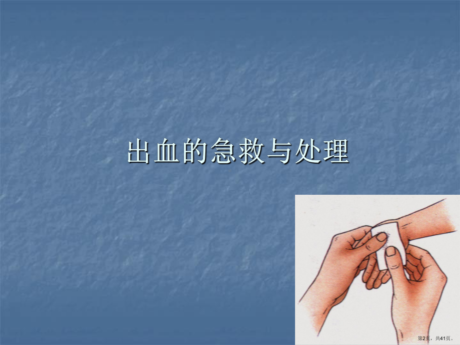 出血的急救与处理PPT医学课件(PPT 41页).pptx_第2页