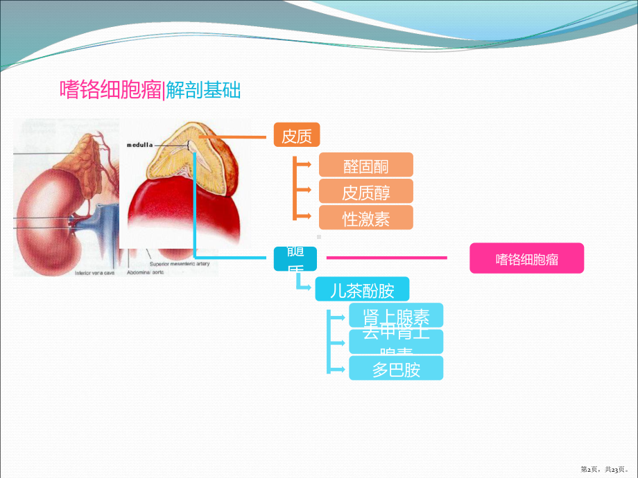 嗜铬细胞瘤影像诊断最新版本课件(PPT 23页).pptx_第2页