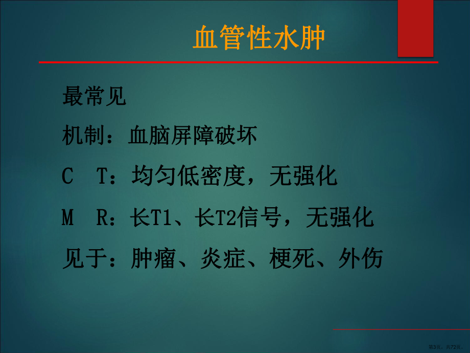 中枢神经系统疾病影像表现课件(PPT 72页).pptx_第3页