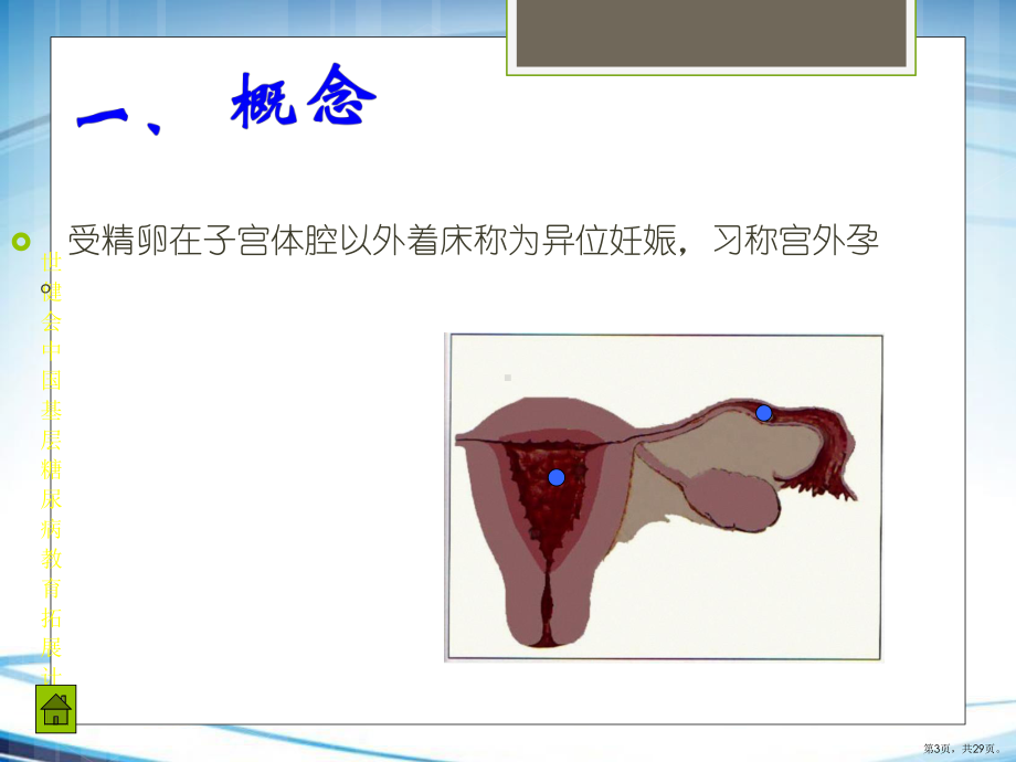 异位妊娠.PPT课件(PPT 29页).pptx_第3页