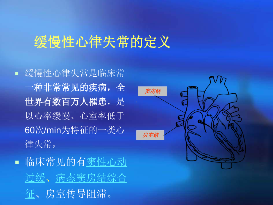 中医药治疗缓慢心律失常特点及优势-PPT课件.ppt_第2页