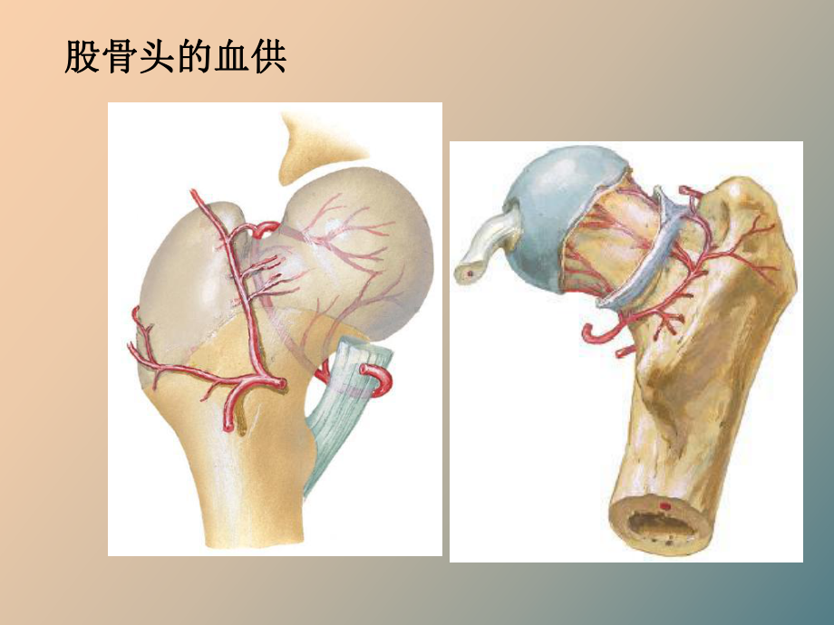 （课件）股骨颈骨折康复.ppt_第3页