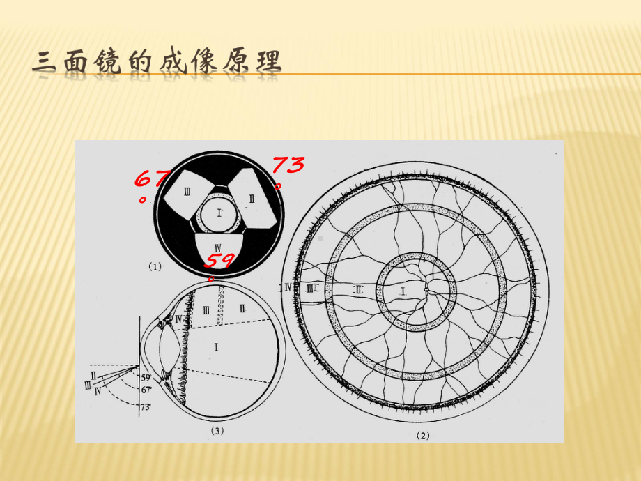 三面镜检查-PPT课件.ppt_第3页