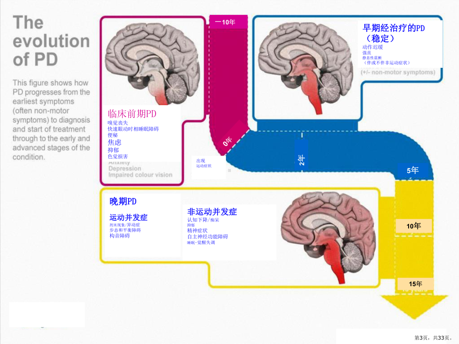 帕金森病的诊断及治疗-课件(PPT 33页).pptx_第3页