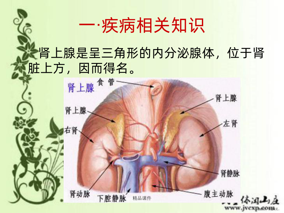 泌尿原醛症护理查房邵琪奇PPT课件(PPT 24页).pptx_第3页