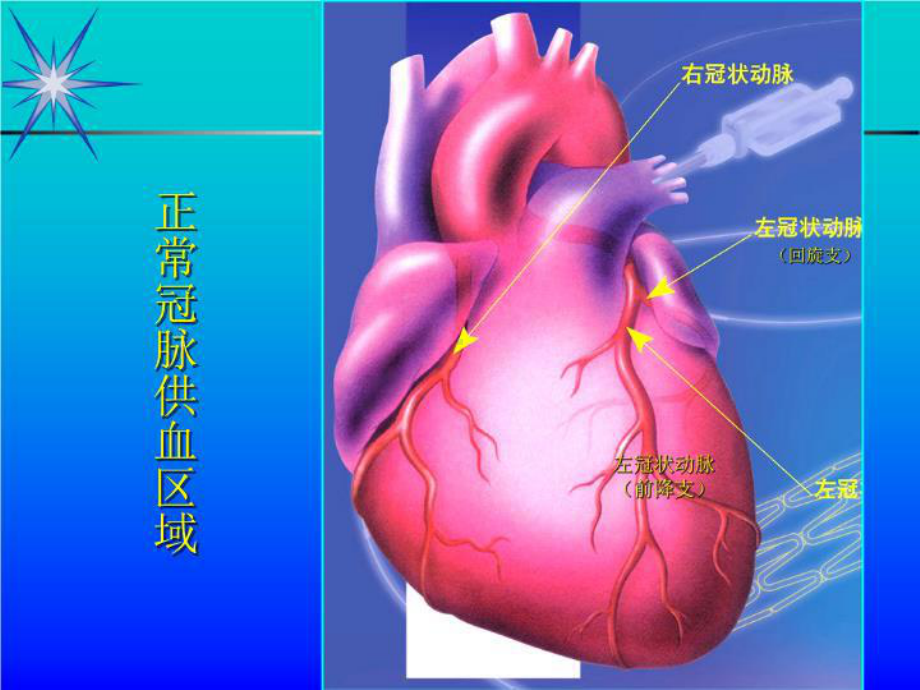 冠心病诊治-PPT课件.ppt_第2页