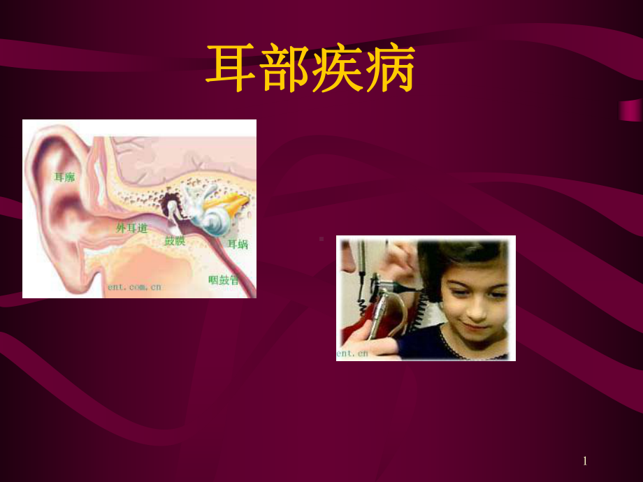 先天性耳前瘘管PPT课件.ppt_第1页