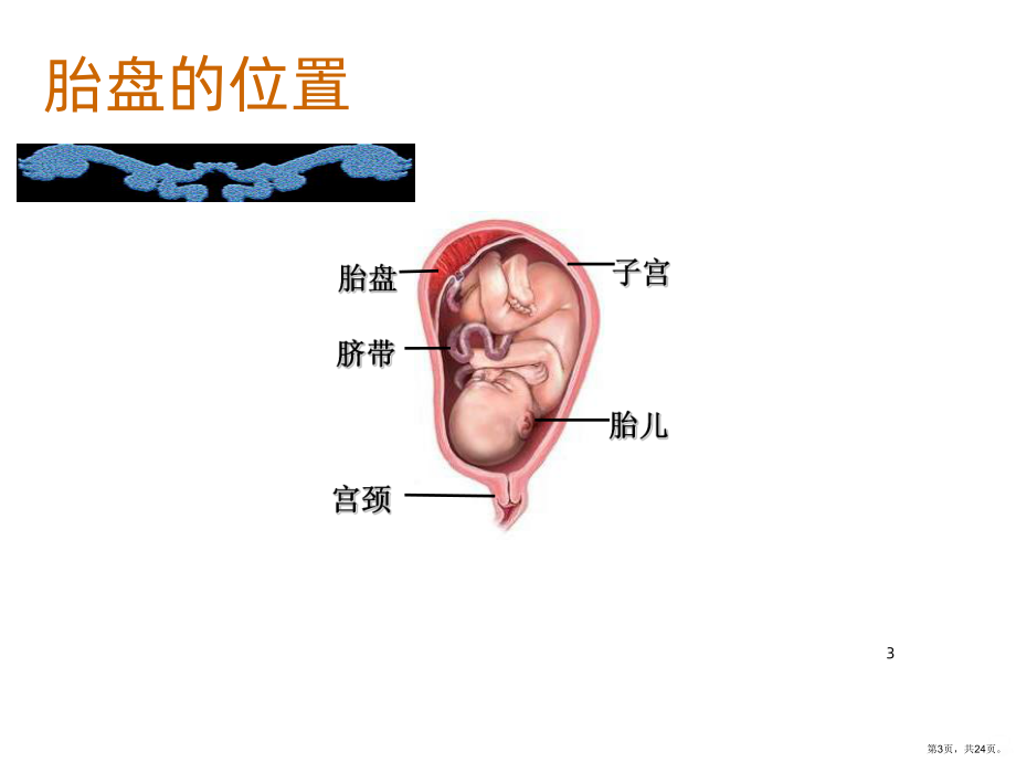 前置胎盘份PPT课件(PPT 24页).pptx_第3页