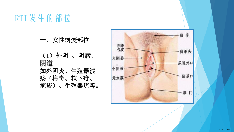 性传播感染和生殖道感染课件(PPT 80页).pptx_第3页