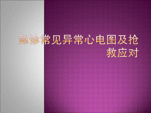 急诊常见异常心电图及抢救应对ppt演示课件(PPT 36页).pptx