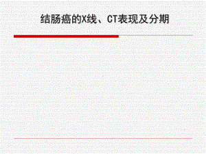 （医学PPT课件）结肠癌的X线、CT表现及分期PPT.ppt