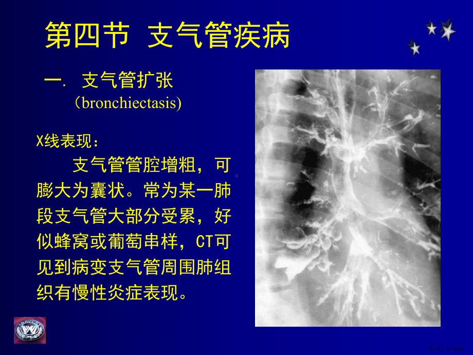 呼吸系统影像诊断课件(PPT 133页).pptx_第1页