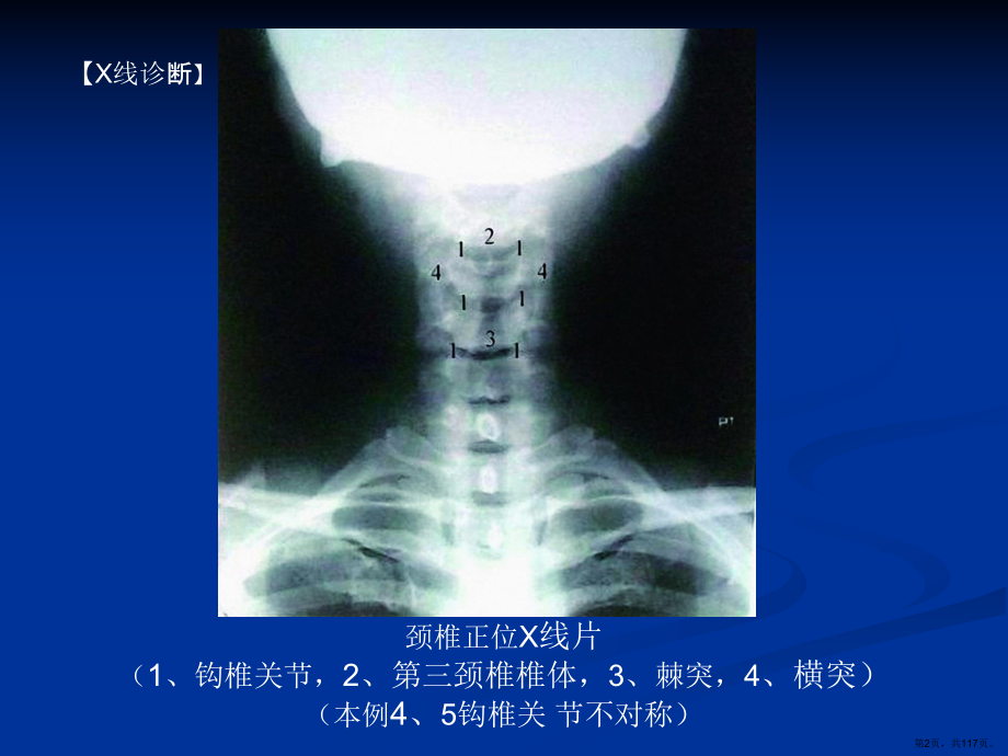 整脊影像学诊断课件(PPT 117页).pptx_第2页